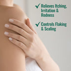 Nizoral Psoriasis Relief Cream- Relieves Itching, Irritation & Redness and Controls Flaking and Scaling with Maximum Strength Me