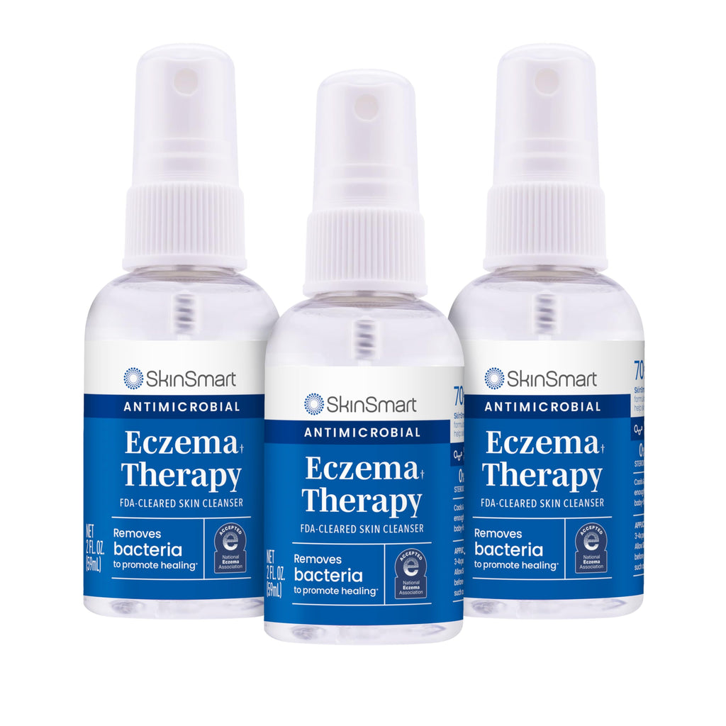 SkinSmart Eczema Therapy, Hypochlorous Antimicrobial Safely Removes Bacteria, so Your Skin Can Heal, Travel Size 2 Ounce Spray (