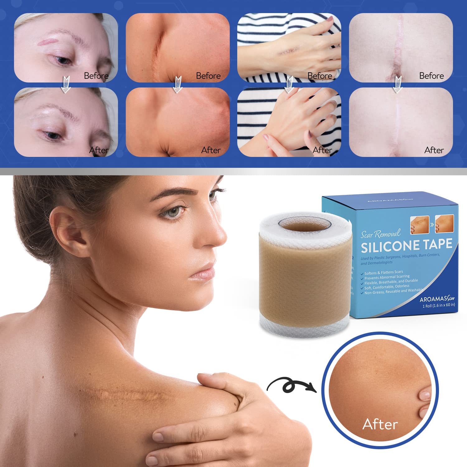 Aroamas Scar Silicone Scar Sheets Silicone Scar Tape 1.6x60 for Softening and Flattening Scars, C-Section, Keloid Surgery, Painl