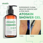 Atoskin Shower & Serum - for Eczema, Psoriasis, Dry, Itchy Skin - with RicoBio JA7 is a Natural Herbal Extract.