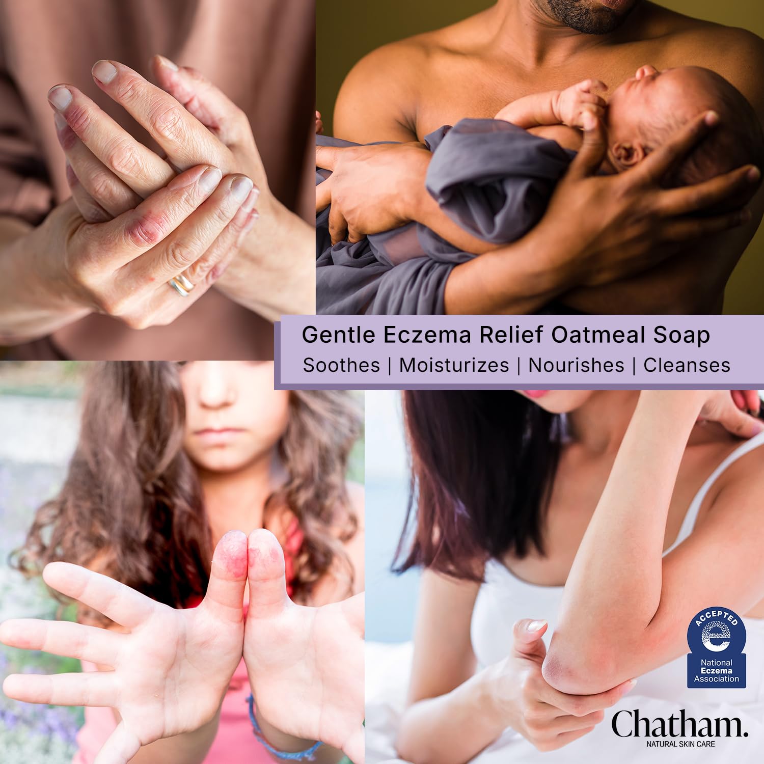 Chatham Natural Skin Care Eczema Relief Oatmeal Soap, oatmeal bath, treatment for eczema rosacea, psoriasis