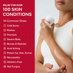 emuaid EMUAIDMAX Eczema Ointment, Maximum Strength Soothing Relief for Eczema, Psoriasis, Athletes Foot, Jock Itch, Rashes, Itch