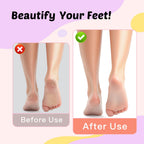 Electric Foot Callus Remover, 9-Speed for Dead Skin & Hard Calluses, Aluminum Alloy, Type-C Rechargeable, Replacement Discs, Spa