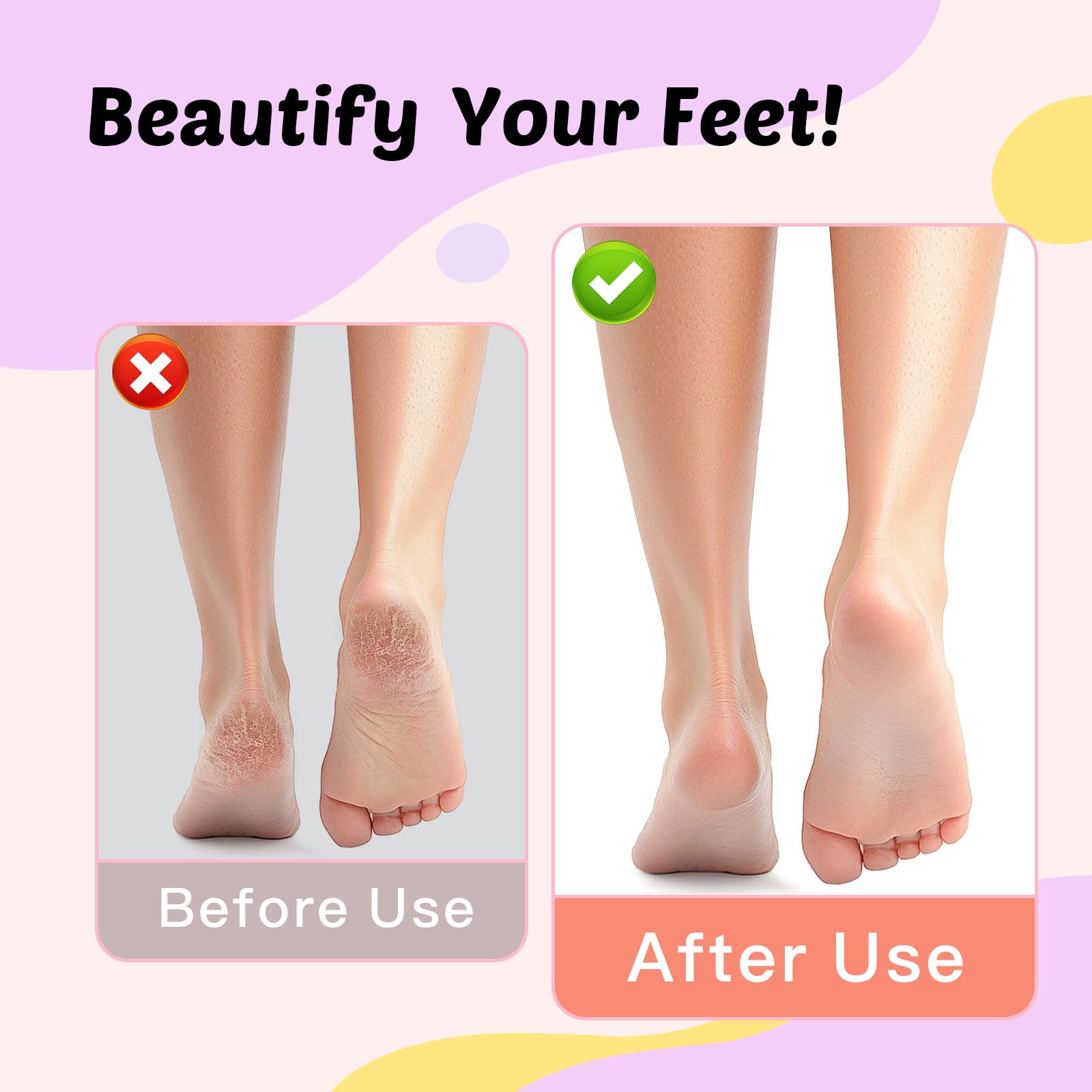 Electric Foot Callus Remover, 9-Speed for Dead Skin & Hard Calluses, Aluminum Alloy, Type-C Rechargeable, Replacement Discs, Spa