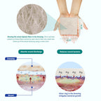 Areza Medical - Silver Alginate (Antibacterial Alginate with Silver) - Wound Dressing Pads - Sterile - 4.25 X 4.25 (10.8 cm X 10