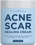 Ayadara Acne Scar Healing Cream, 2 fl oz, Acne Scar Treatment for Face, Stretch Marks, Body Scars, Acne Scar Removal Cream for B