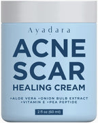 Ayadara Acne Scar Healing Cream, 2 fl oz, Acne Scar Treatment for Face, Stretch Marks, Body Scars, Acne Scar Removal Cream for B