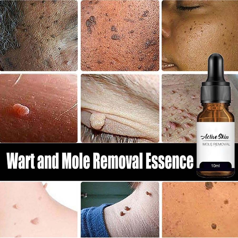 Professional Wart & Mole Remover Serum - Gentle Skin Tag Corrector for Face, Neck & Body with Glycerin & Panthenol - Fast Acting