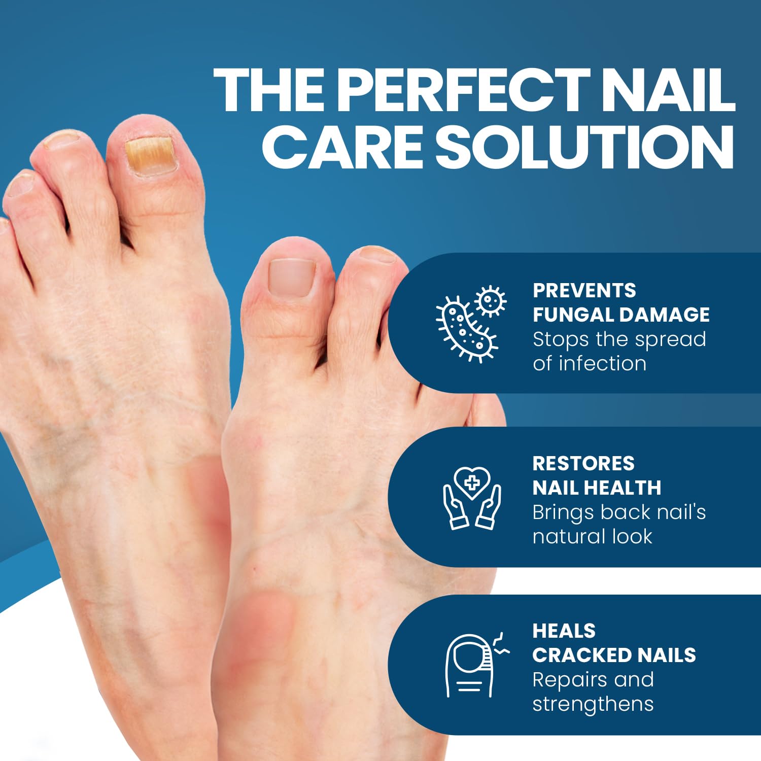 FUNGINIX Toenail Fungus Treatment - Extra Strength - Nail Fungus Treatment & Athletes Foot Solution - Antifungal Liquid Solutio