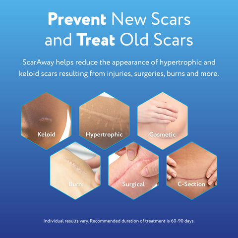 ScarAway Advanced Silicone Scar Sheets, Medical Grade Variety Pack Silicone Strips, Scar Treatment & Prevention for Surgical, Bu