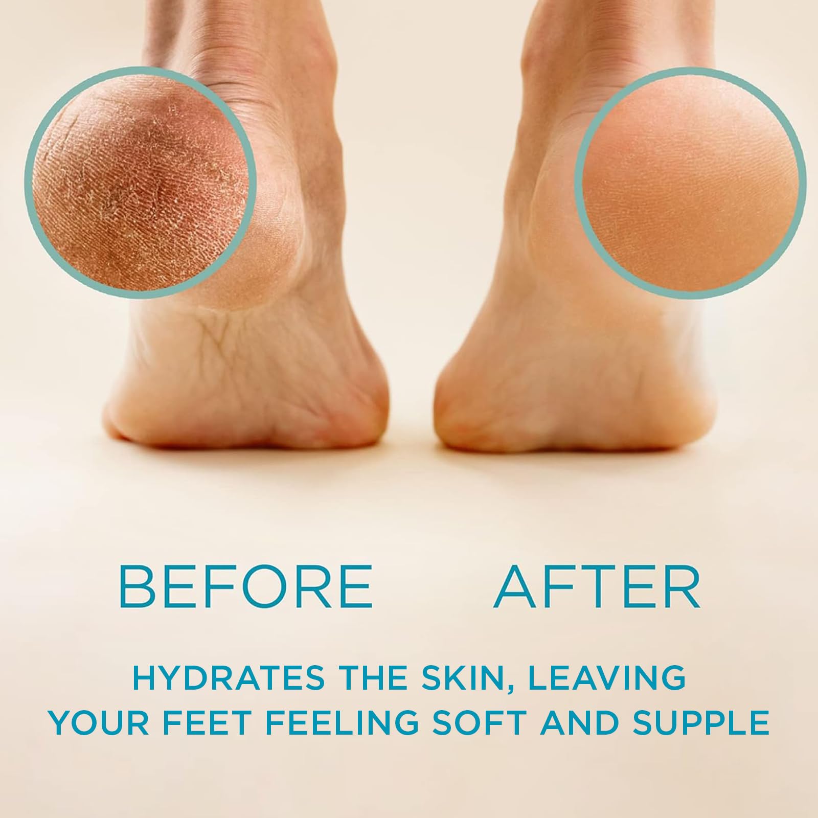Lee Beauty Professional Callus Remover for Feet - Original, Powerful Formulation - Extra Strength Gel, Home Pedicure Foot Spa Re