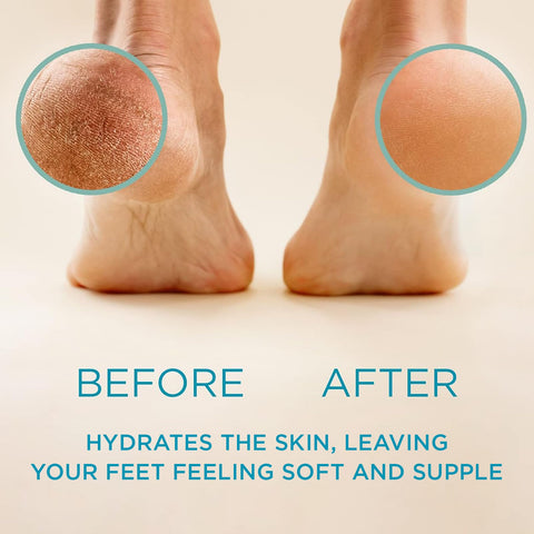 Lee Beauty Professional Callus Remover for Feet - Original, Powerful Formulation - Extra Strength Gel, Home Pedicure Foot Spa Re