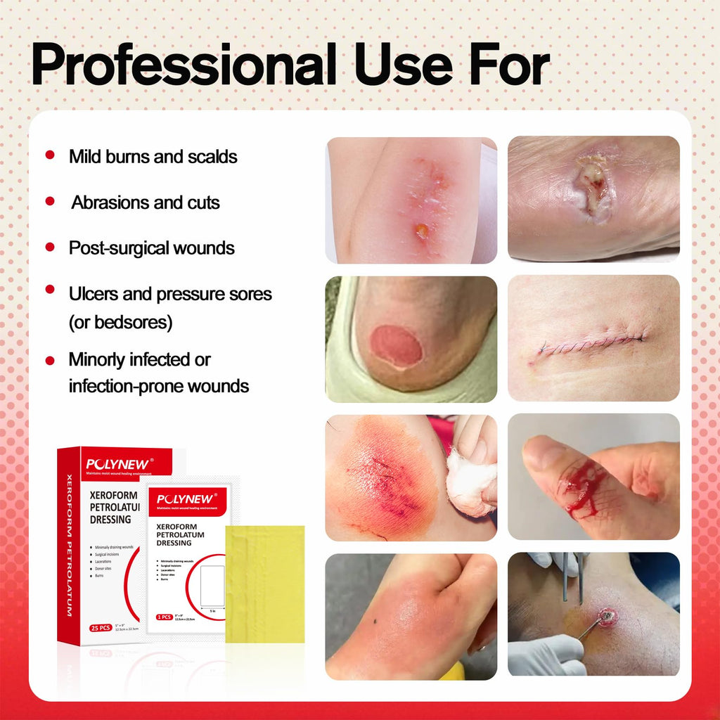 POLYNEW Xeroform Petrolatum Dressing 5x9, 25 PCS Non-Adherent Gauze for Low Exudating Wounds, Fine Mesh Gauze Pads for Burns, Ab