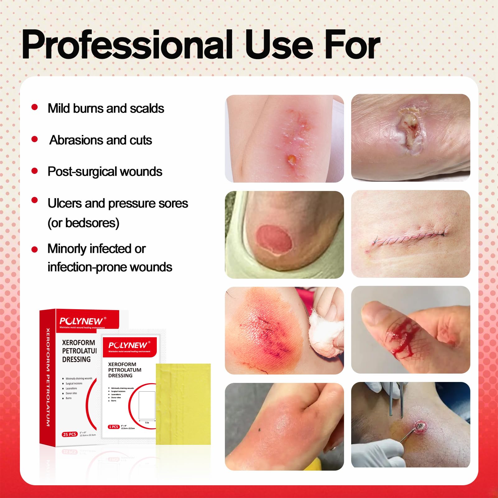POLYNEW Xeroform Petrolatum Dressing 5x9, 25 PCS Non-Adherent Gauze for Low Exudating Wounds, Fine Mesh Gauze Pads for Burns, Ab