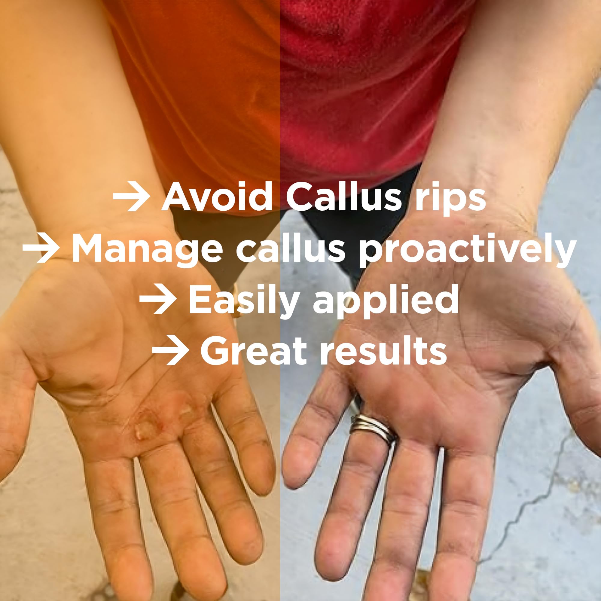 Proactive and Reactive Hand Callus Shaver | Callus Remover for Hands and Athletes Doing Weights or Crossfit Training | Ultra Pre