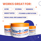 Mite-B-Gone Mite Cream & Bite Relief - 10% Natural Blend Sulfur Cream for Multi-Purpose Bites, Redness, Itching, & Irritation |