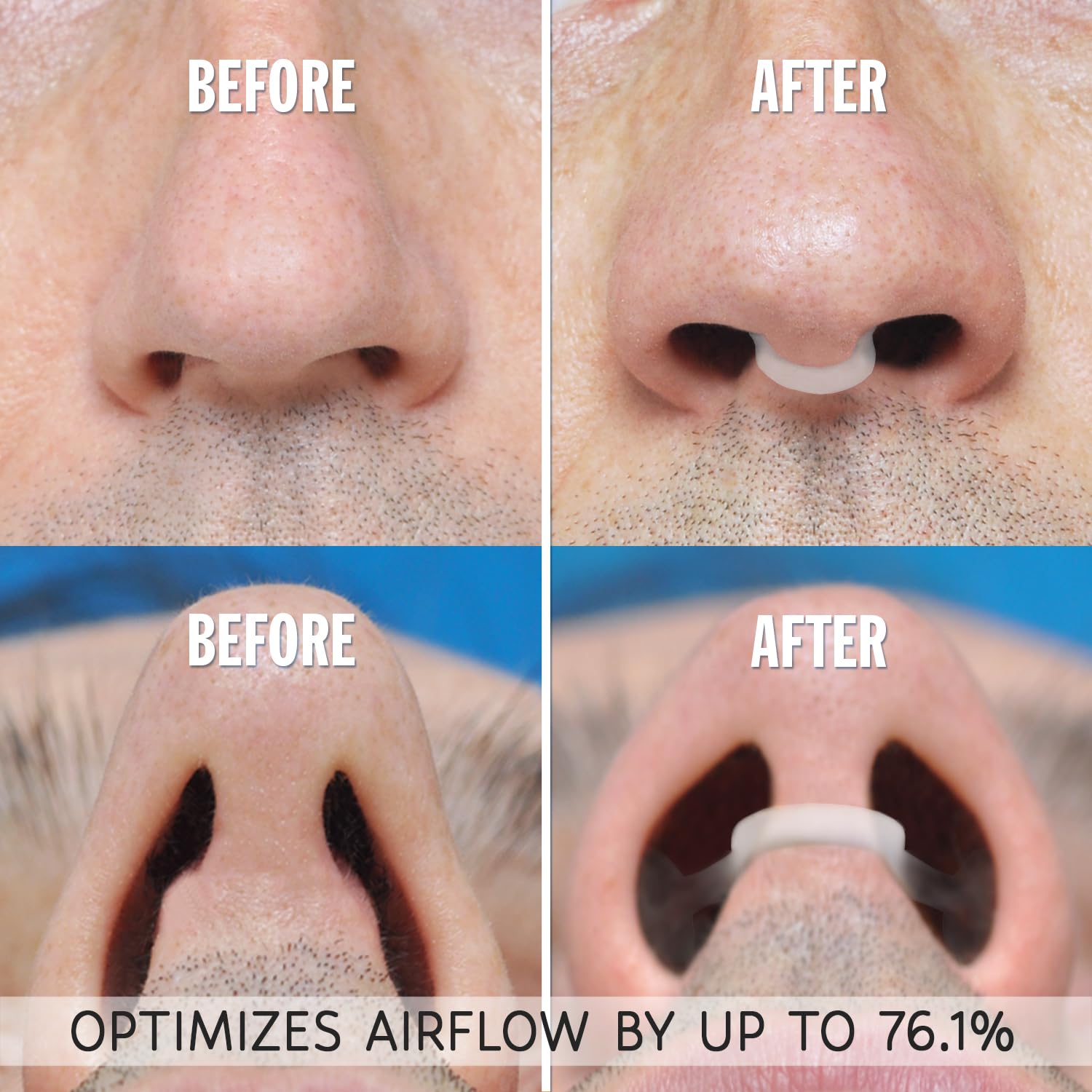 AIRMAX Nasal Dilator for Better Sleep - Natural, Comfortable, Anti Snoring Device, Snoring Solution for Maximum Airflow and Easi