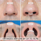 AIRMAX Nasal Dilator for Better Sleep - Natural, Comfortable, Anti Snoring Device, Snoring Solution for Maximum Airflow and Easi