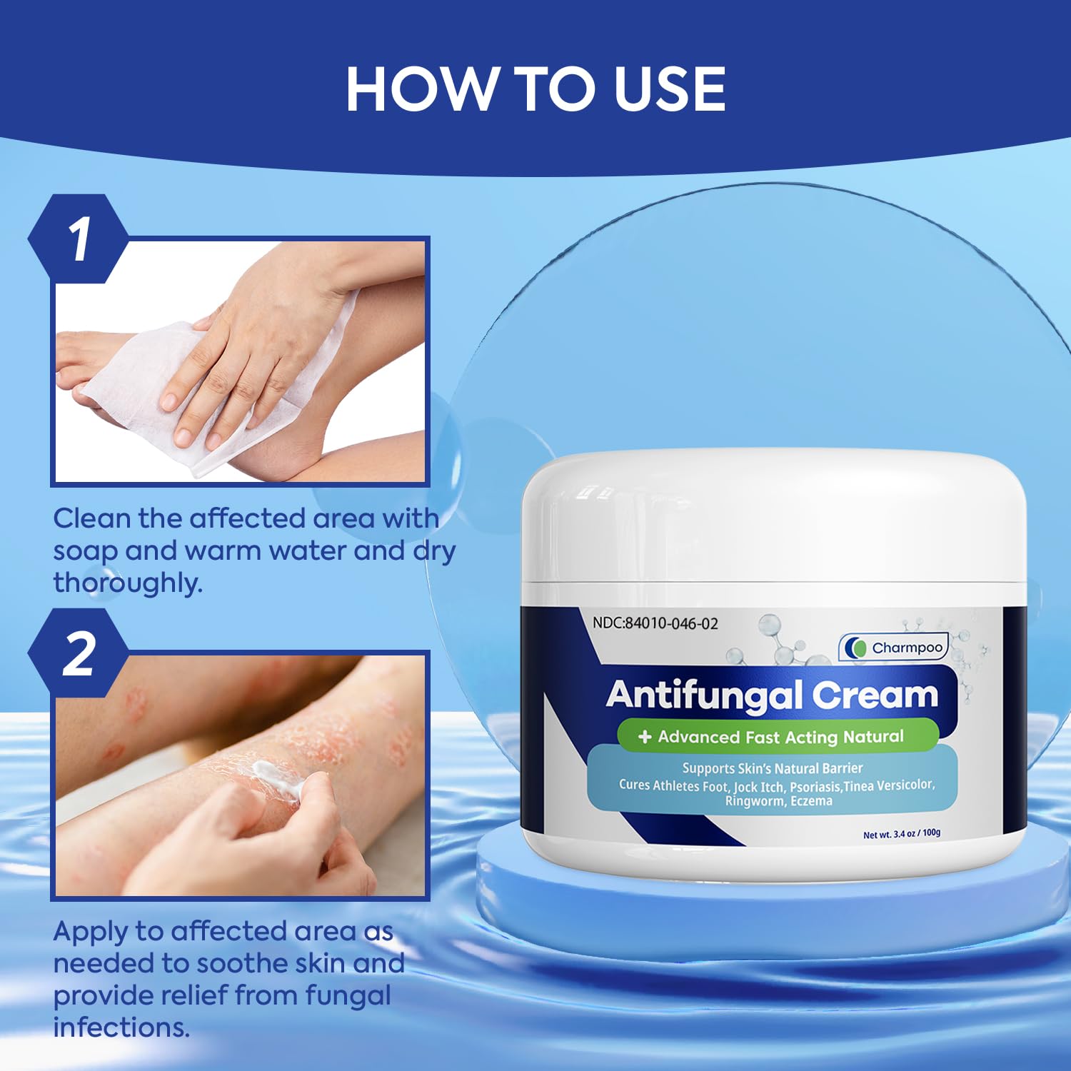 Charmpoo Antifungal Cream for Jock Itch: 2% Miconazole Anti Fungal Cream for Itchy Skin Relief Extra Strength - Ringworm Treatme