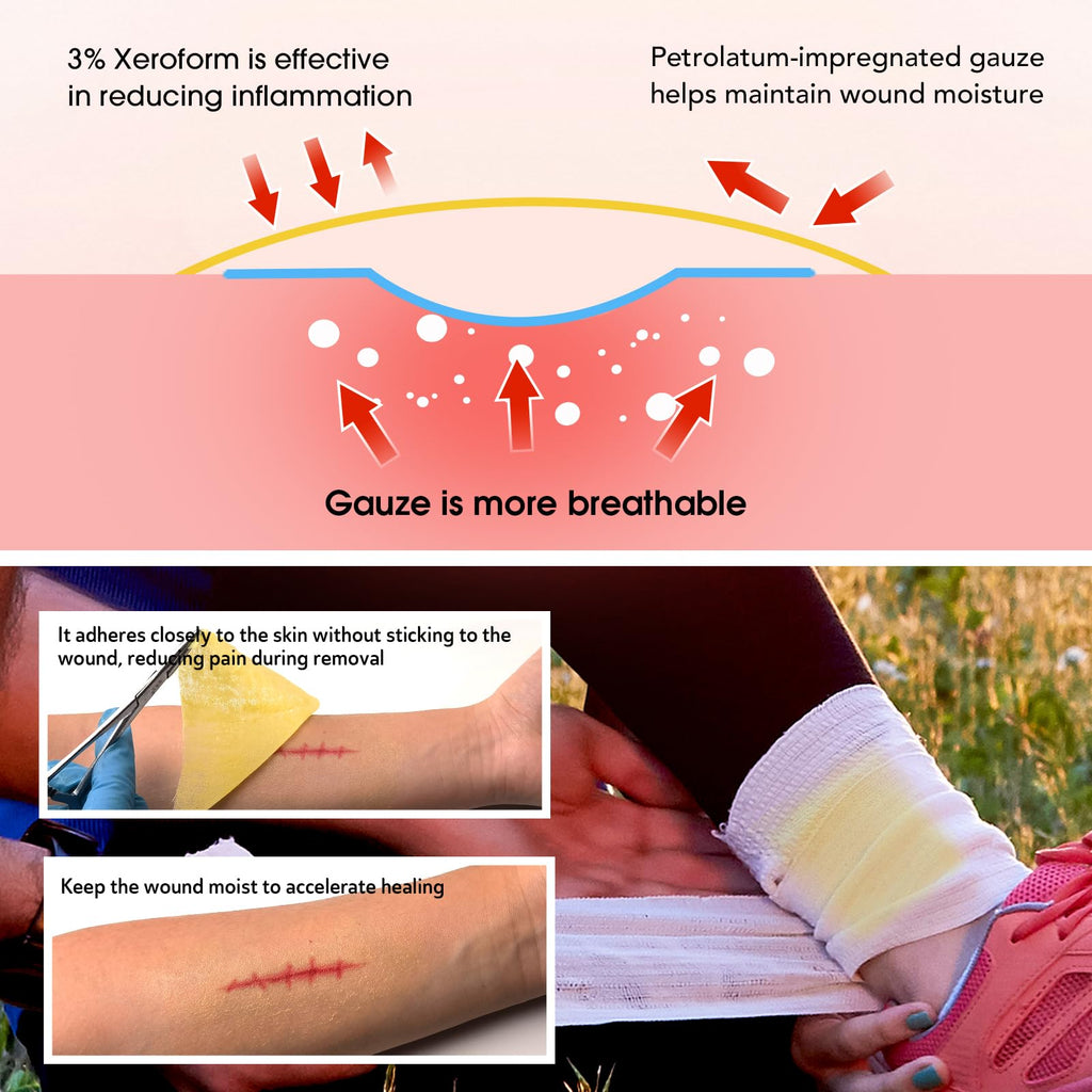 POLYNEW Xeroform Petrolatum Dressing 4x4, 25 PCS Non-Adherent Gauze for Low Exudating Wounds, Fine Mesh Gauze Pads for Burns, Ab