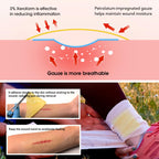 POLYNEW Xeroform Petrolatum Dressing 4x4, 25 PCS Non-Adherent Gauze for Low Exudating Wounds, Fine Mesh Gauze Pads for Burns, Ab