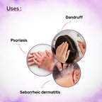 Plaintar Coal Tar 5% Leave on Lotion Reduces Scaling Dryness & Itching Coal Tar Lotion for Dandruff Psoriasis & Seborrheic Derma