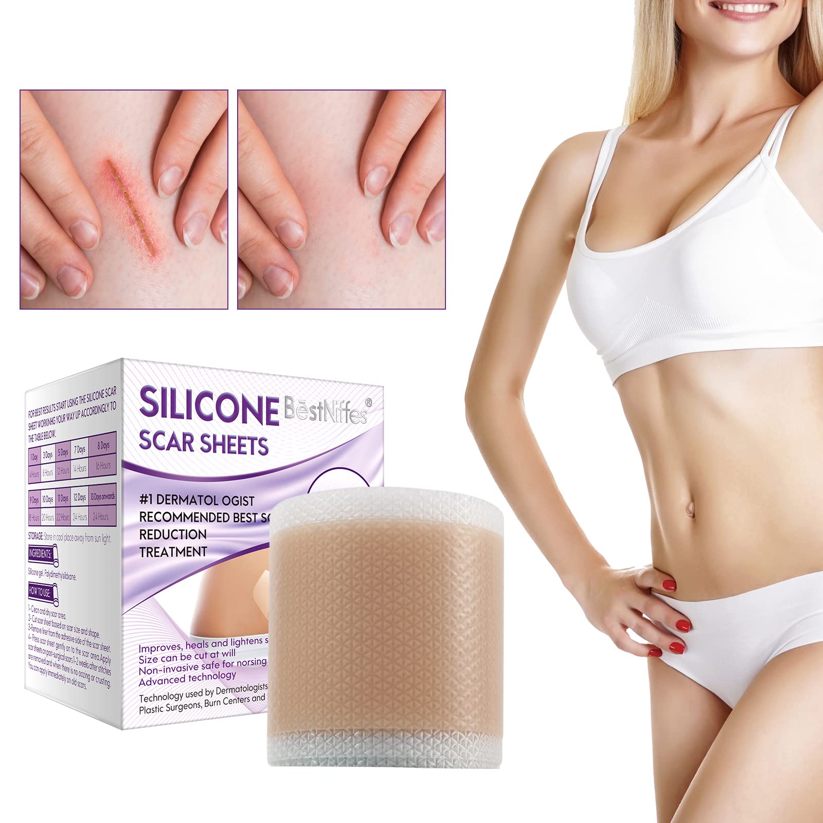 Silicone Scar Sheets, Silicone Scar Tape Roll(1.6    x 60   Roll-6 Month Supply), Professional Scar Removal Strips, Reusable, Me
