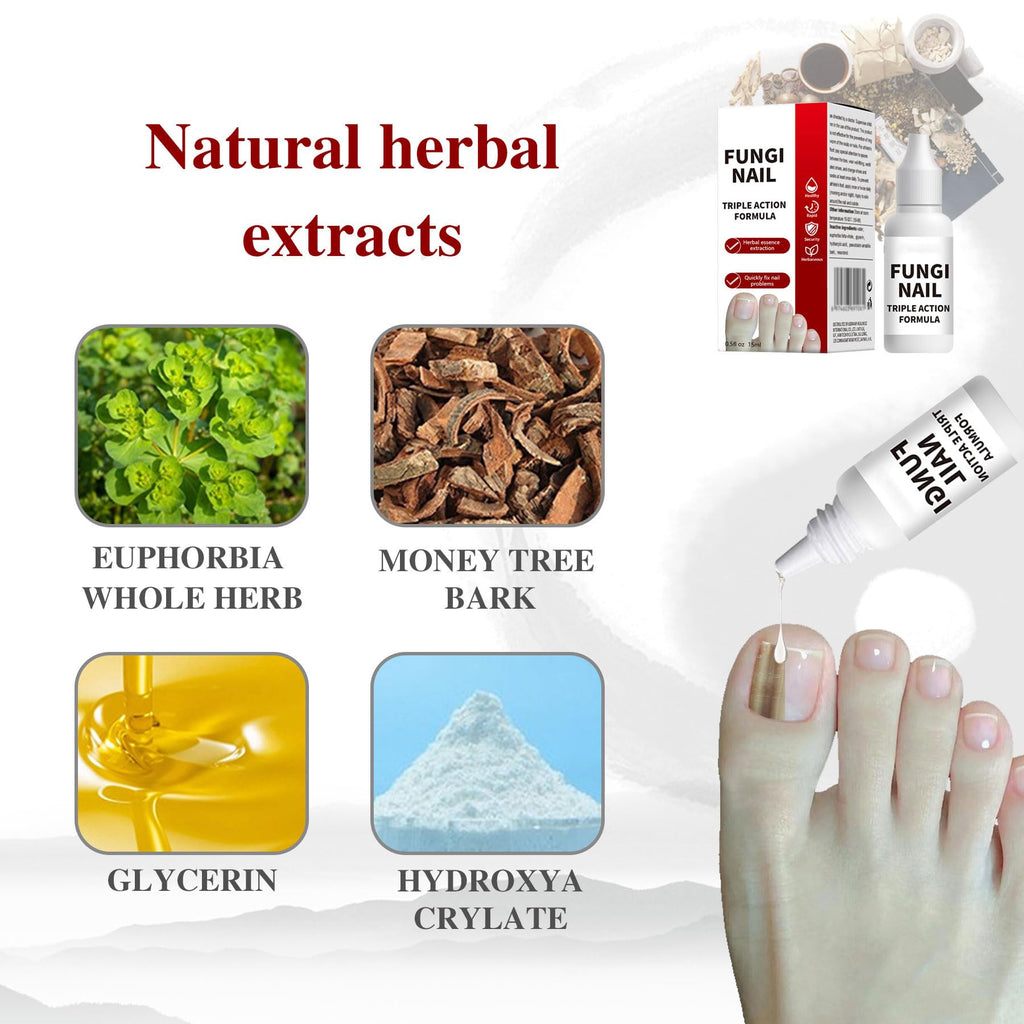 Toenail Fungus Treatment, Herbal Extracts, Nighttime Long-Lasting Nail Treatment, Suitable for Discoloration, Shaped Nails, Thic