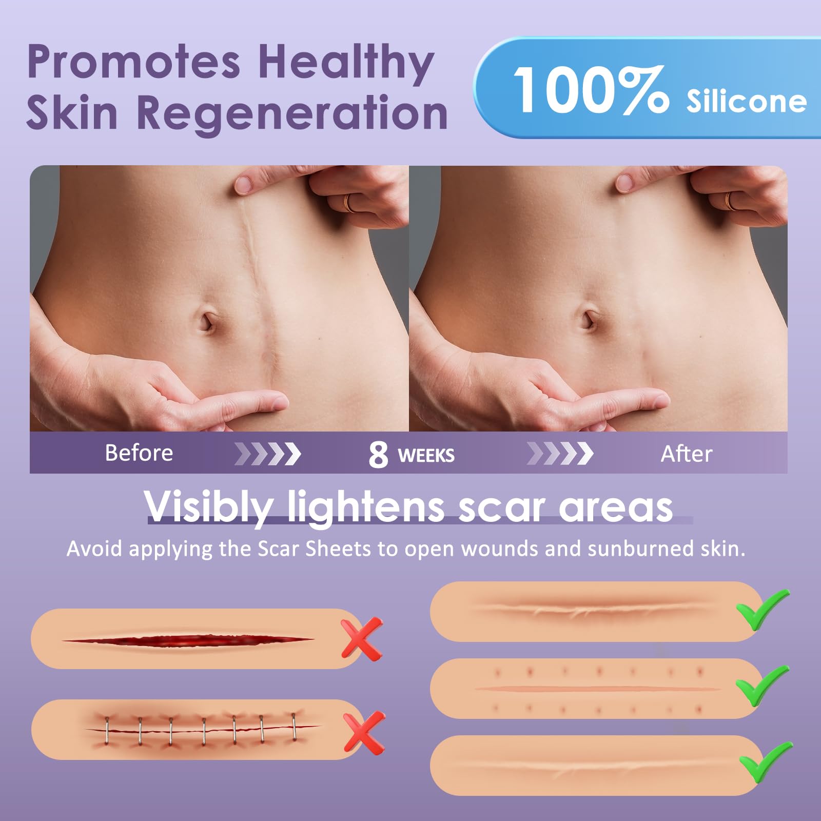 Skiennix Silicone Scar Tape for Surgical Scars - 1.6 x 120 300CM Roll - Reusable - Ultra Thin & Soft Scar Sheets for C-Sections,