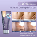 Skiennix PM Intensive Overnight Scar Cream 1.06 oz, Medical Grade Silicone Scar Gel, Promotes Skin Regeneration When You Sleep,