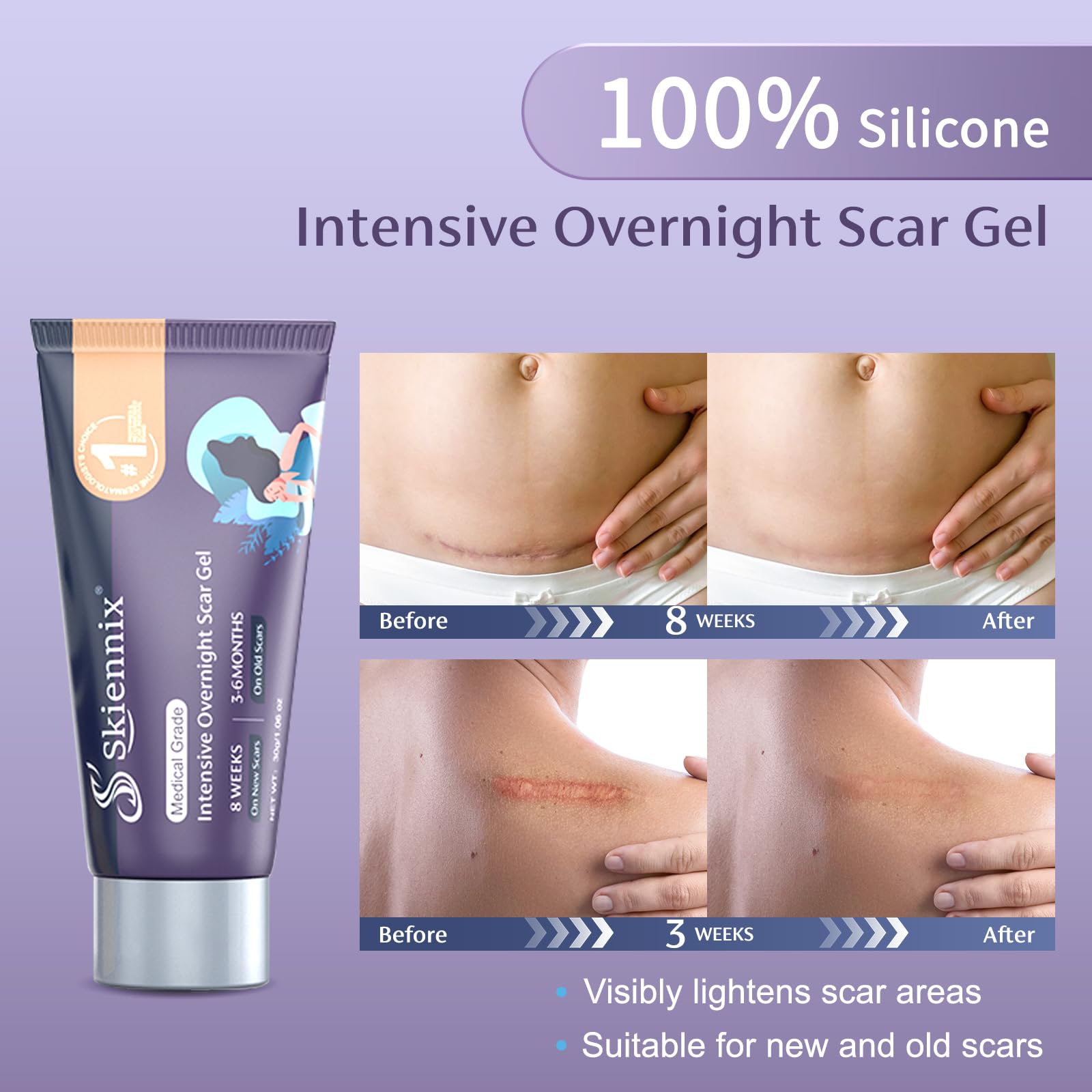 Skiennix PM Intensive Overnight Scar Cream 1.06 oz, Medical Grade Silicone Scar Gel, Promotes Skin Regeneration When You Sleep,