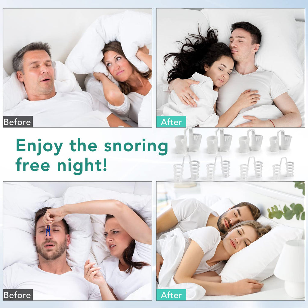 Anti Snoring Nose Vent Nasal Cones Nasal Dilator to Stop Snoring Effective Snore Stopper Anti Snoring Devices Easy to Use Snorin