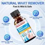 HEALMUSZ Wart Remover Liquid 5% Salicylic Acid Wart Freeze Off Wart Removal,Wart Remover Freeze Off for Genital,H Wa rt,Common,F