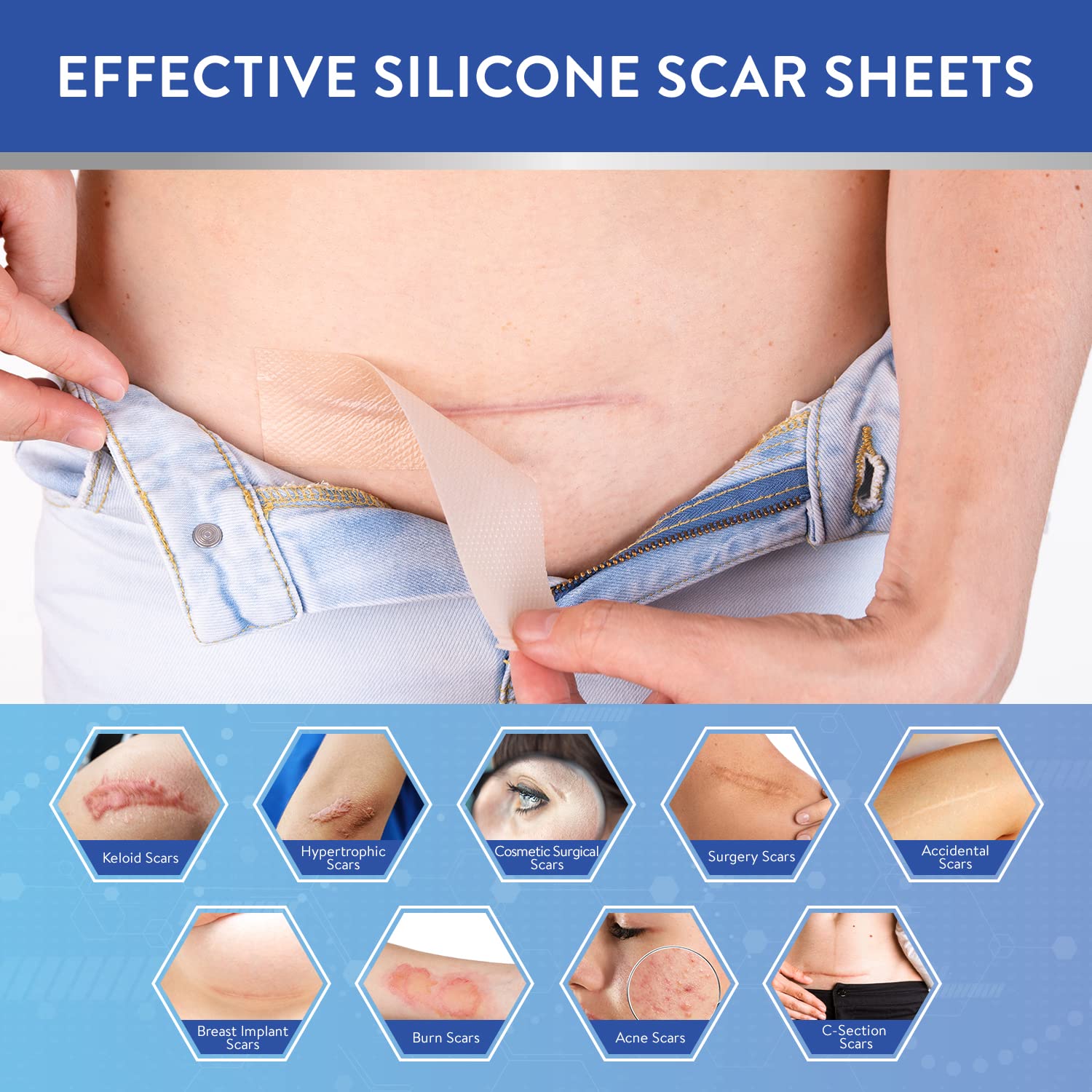 Aroamas Scar Silicone Scar Sheets Silicone Scar Tape 1.6x60 for Softening and Flattening Scars, C-Section, Keloid Surgery, Painl