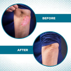 Baar Products - American Saffron Herbal Tea - Digestive Aid & Intestinal Cleansing, Helps Relieve Psoriasis, Eczema, Dermatitis