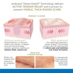 Embrace Active Scar Defense for New Scars, FDA-Cleared Silicone Scar Sheets, 4.7 Inch, Large, 30 Day Supply