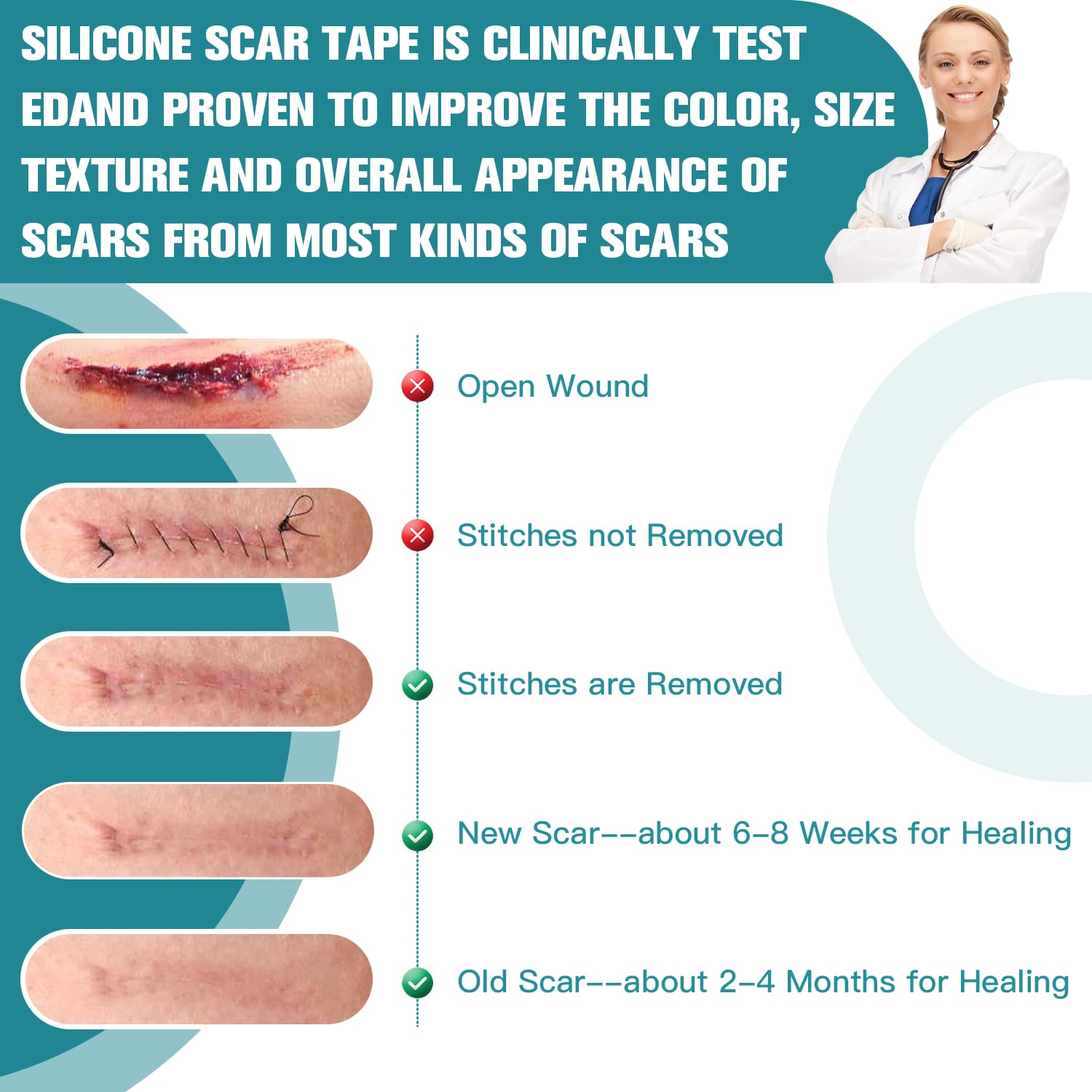 Silicone Scar Sheets,Silicone Scar Tape For Surgical Scars,0.55mm Thicked Silicone Scar Removal Strips For Surgical,C-Section,Tu
