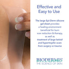 Epi-Derm Large Sheets, Premium Grade Silicone Scar Sheets for C-Section, Tummy Tuck, Hysterectomy & Cardiac Surgery Scars, Easy