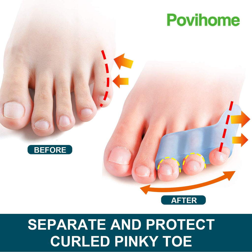 Povihome 10 Pack Pinky Toe Separator and Protectors for Overlapping Toe, Curled Pinky Toes - Spacers for Morton's Neuroma Pain R