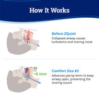 ZQuiet Anti-Snoring Mouthpiece Solution - Comfort Size #2 (Single Device) + Cleaner (1.5oz Bottle) - Made in USA Snoring Solutio