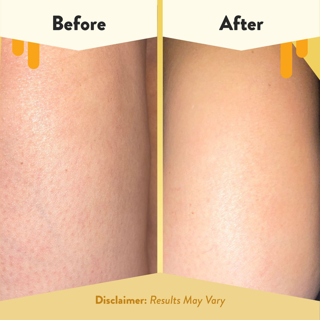 ECZEMA HONEY Soothing Body Wash - Daily Shower Gel & Eczema Treatment - Sensitive Skin Body Wash for Adults, Kids, & Babies - Bo