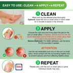 Corn Remover Pads for Feet Toes: 30 Pack 40% Salicylic Acid Extra Strength Treatment - Fast Effective Medicated Bandages for Adu