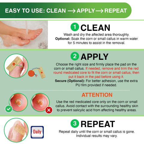Corn Remover Pads for Feet Toes: 30 Pack 40% Salicylic Acid Extra Strength Treatment - Fast Effective Medicated Bandages for Adu
