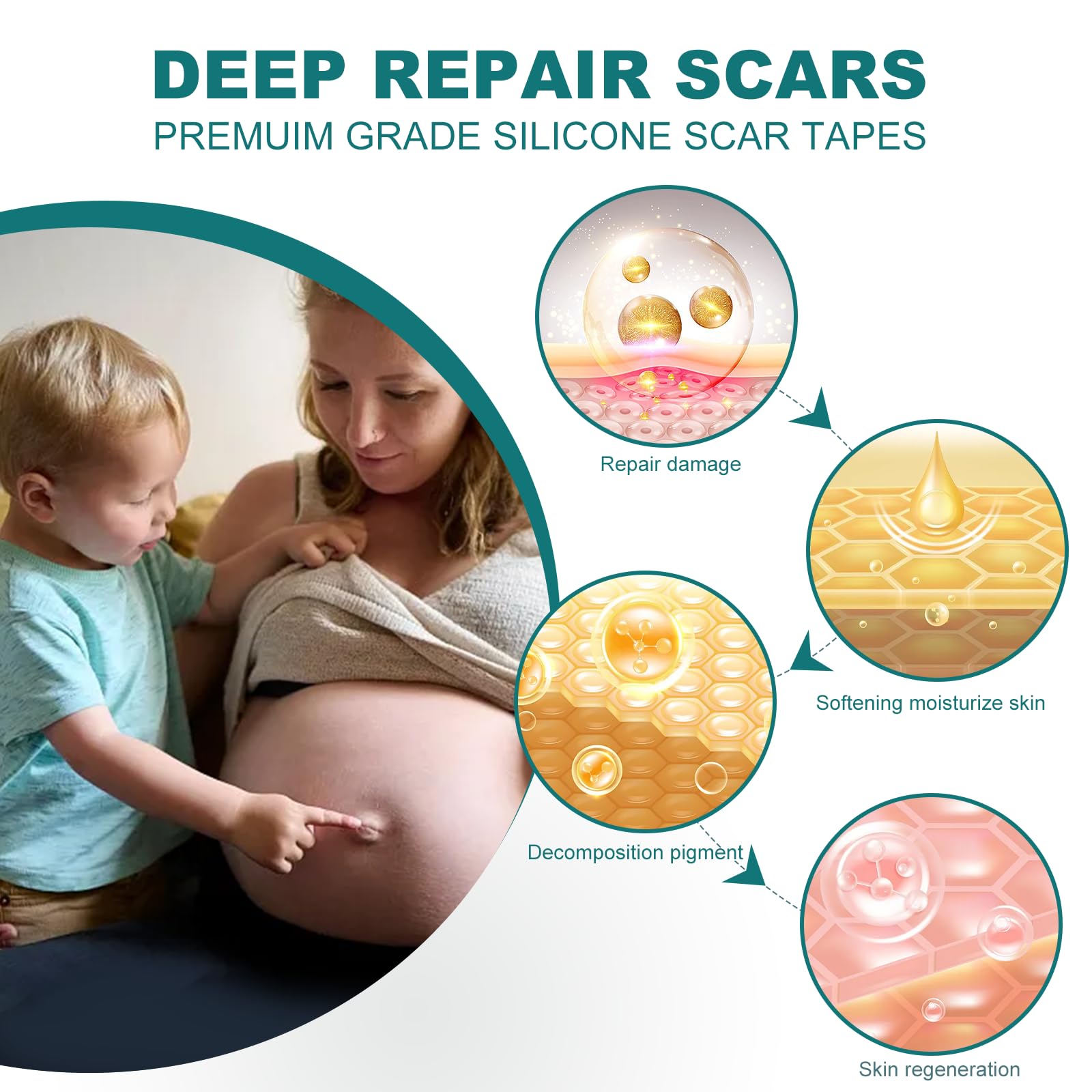 Silicone Scar Sheets (1.6''x 79'' Roll-2M), Silicone Scar Tape for Scar Removal Treatment, Reusable Silicone Scar Strips for C-S