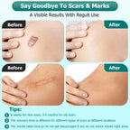 Gowgaw Scar Gel, Scar Cream, Advance Scar Gel for Surgical Scars,Face,Body,Leg, Burns, Acene,C-Section, Stretch Marks, Keloids,S