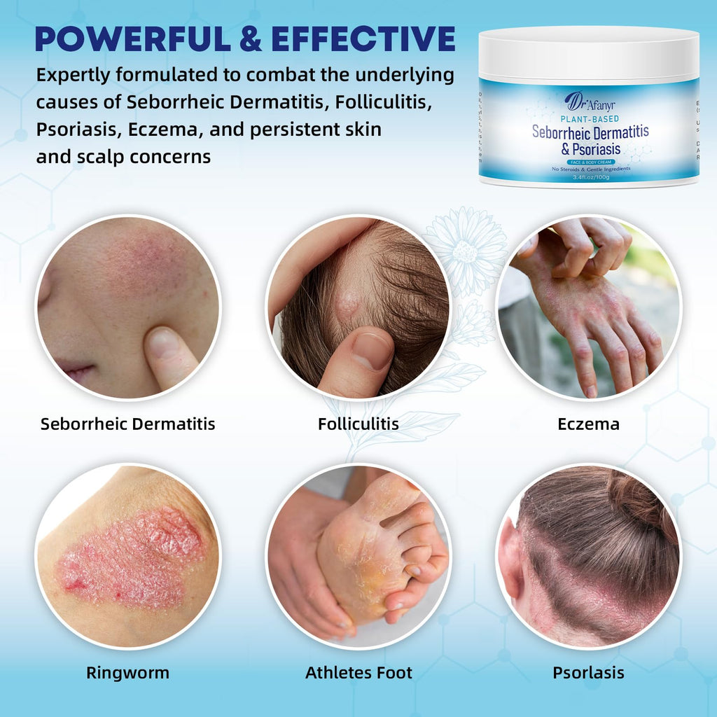 DR.Afanyr Seborrheic Dermatitis Psoriasis Care Cream - Dry Scalp Face & Body Moisturizer with Anti Itch & Dandruff Relief, Daily