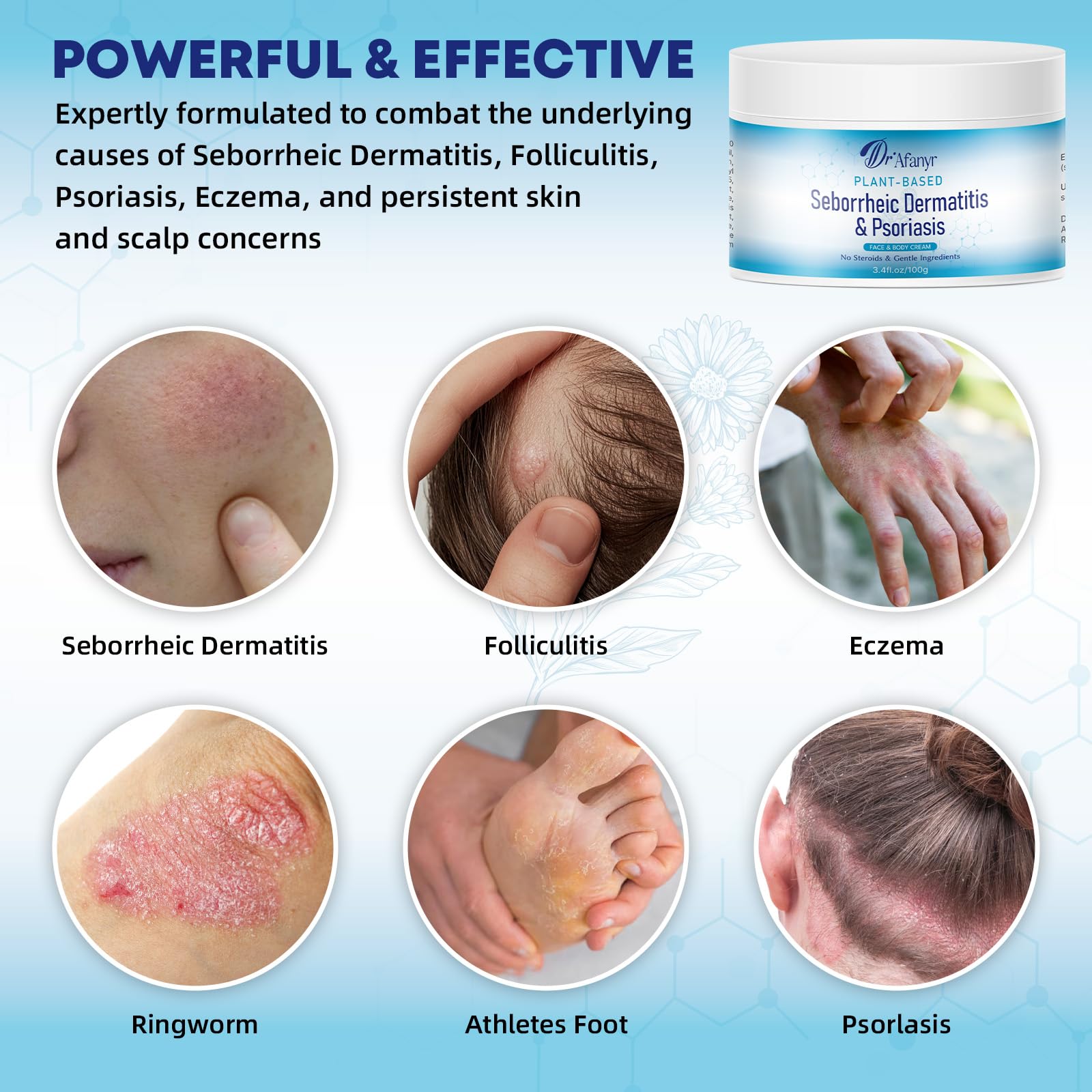DR.Afanyr Seborrheic Dermatitis Psoriasis Care Cream - Dry Scalp Face & Body Moisturizer with Anti Itch & Dandruff Relief, Daily