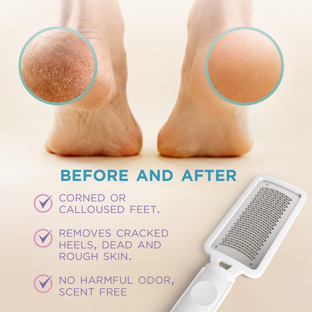 Lee Beauty Professional Callus Remover for Feet-Rasp Foot File Scrubber for Dead Skin Remover for Cracked Heels & Dry Skin-Sturd