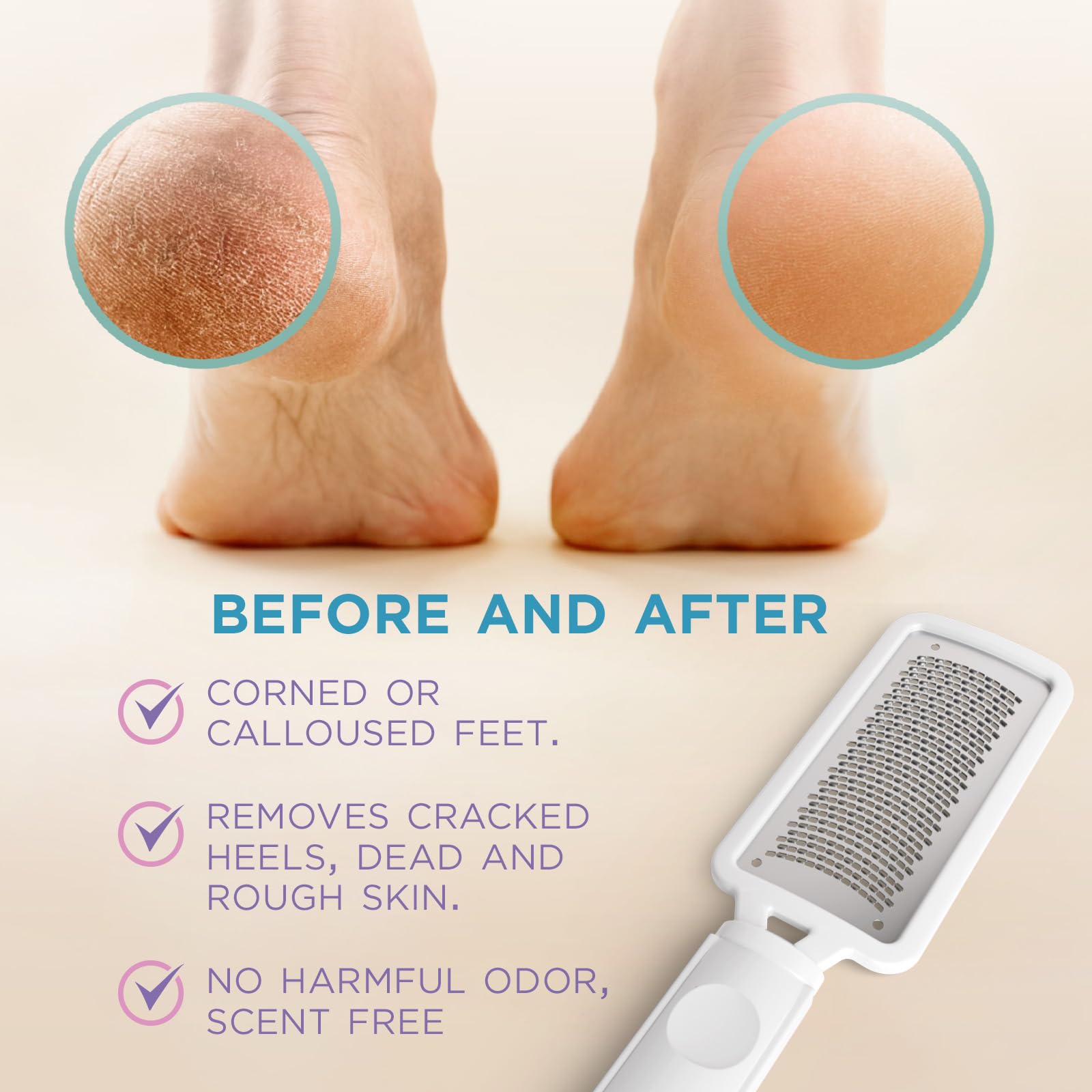 Lee Beauty Professional Callus Remover for Feet-Rasp Foot File Scrubber for Dead Skin Remover for Cracked Heels & Dry Skin-Sturd