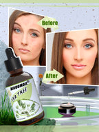 Airoomoil Tea Tree Essential Oil for Skin Muscle Hair Shampoo Body Wash Nails Aroma Natural Diffuser Oil 4 Fl Oz